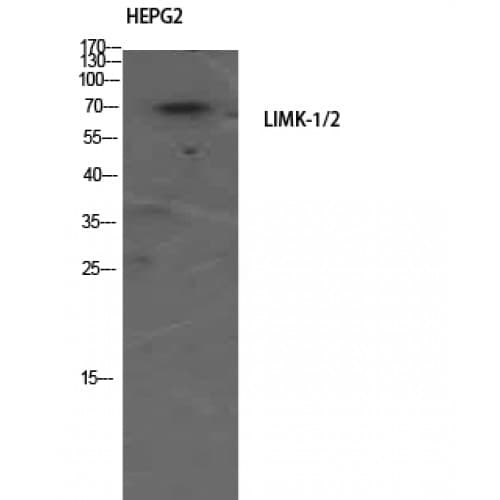 LIMK1 + LIMK2 Antibody (450-530 aa)