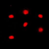 RB1 / Retinoblastoma / RB Antibody (C-Terminus)