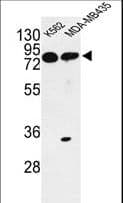 PRKAA1 / AMPK Alpha 1 Antibody