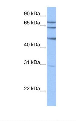 TSKS Antibody (N-Terminus)