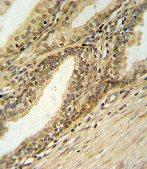 DFFB Antibody (aa1-30)