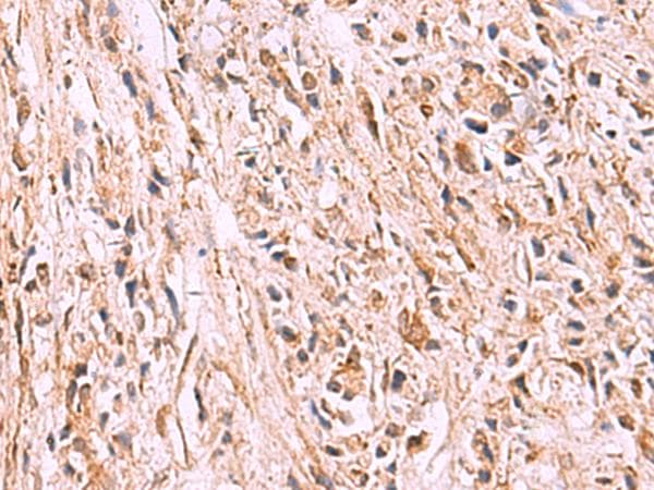 GPC2 / Glypican 2 Antibody