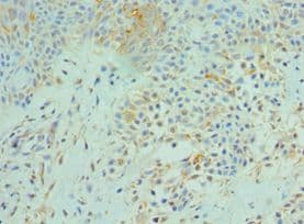 SRPK1 Antibody (aa290-480)