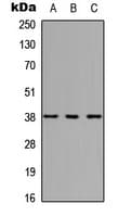 HOXC10 Antibody (Internal)