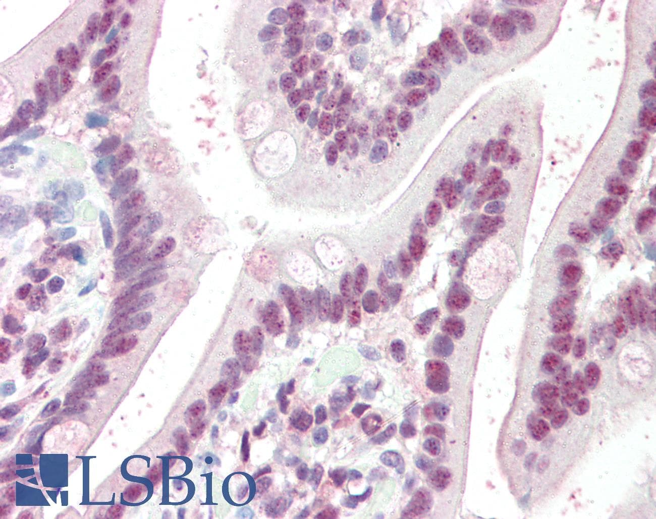 IHC-plus™ Polyclonal Goat anti-Human QIP1 / KPNA4 Antibody (aa509-521, IHC, WB)
