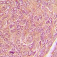 AKAP1 / AKAP Antibody (aa286-325)