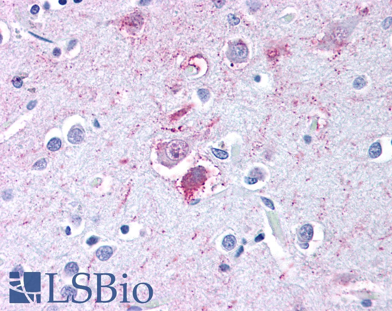 IHC-plus™ TACR1 / NK1R Antibody (C-Terminus)