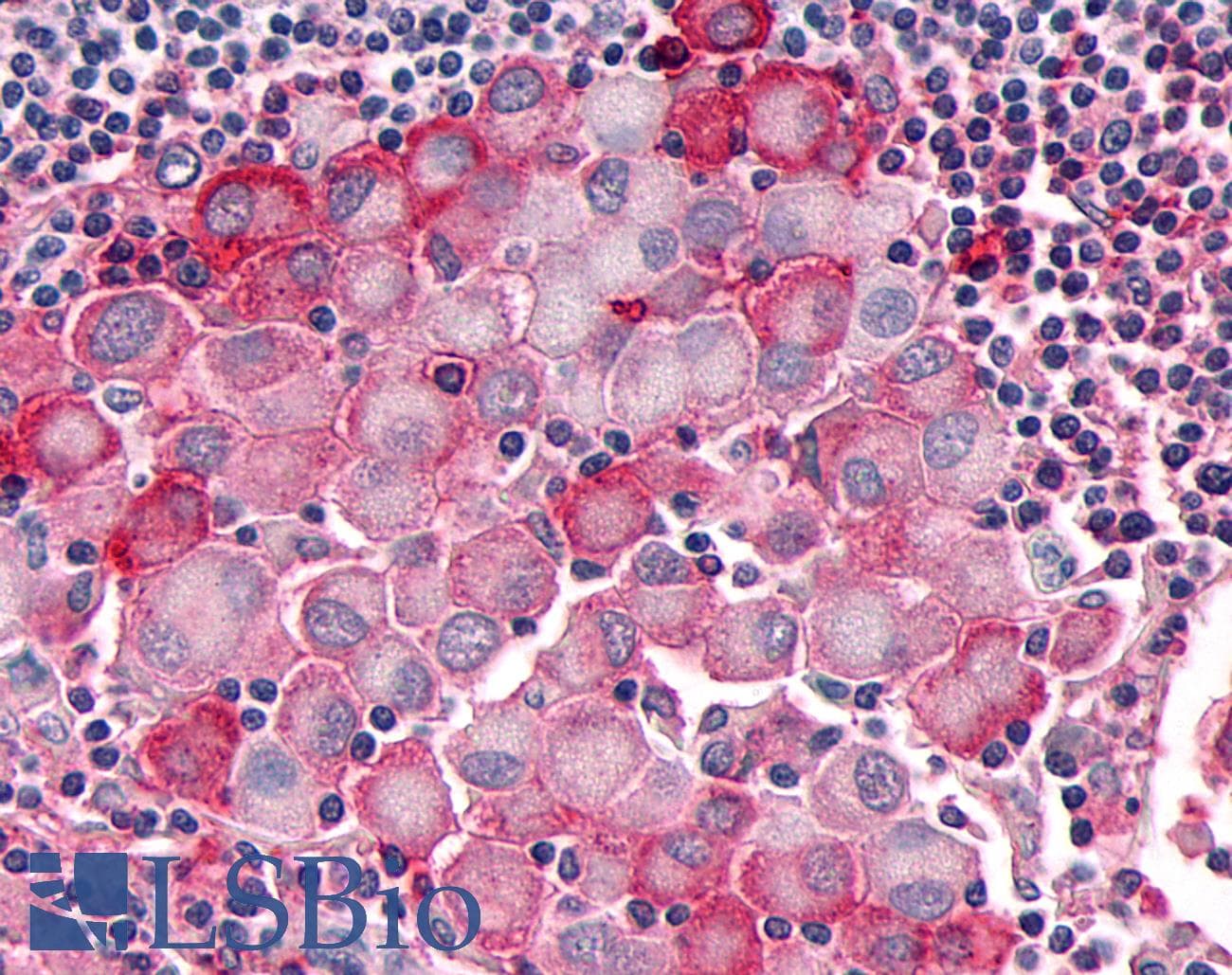 PathPlus™ OR10R2 Antibody (Extracellular Domain)