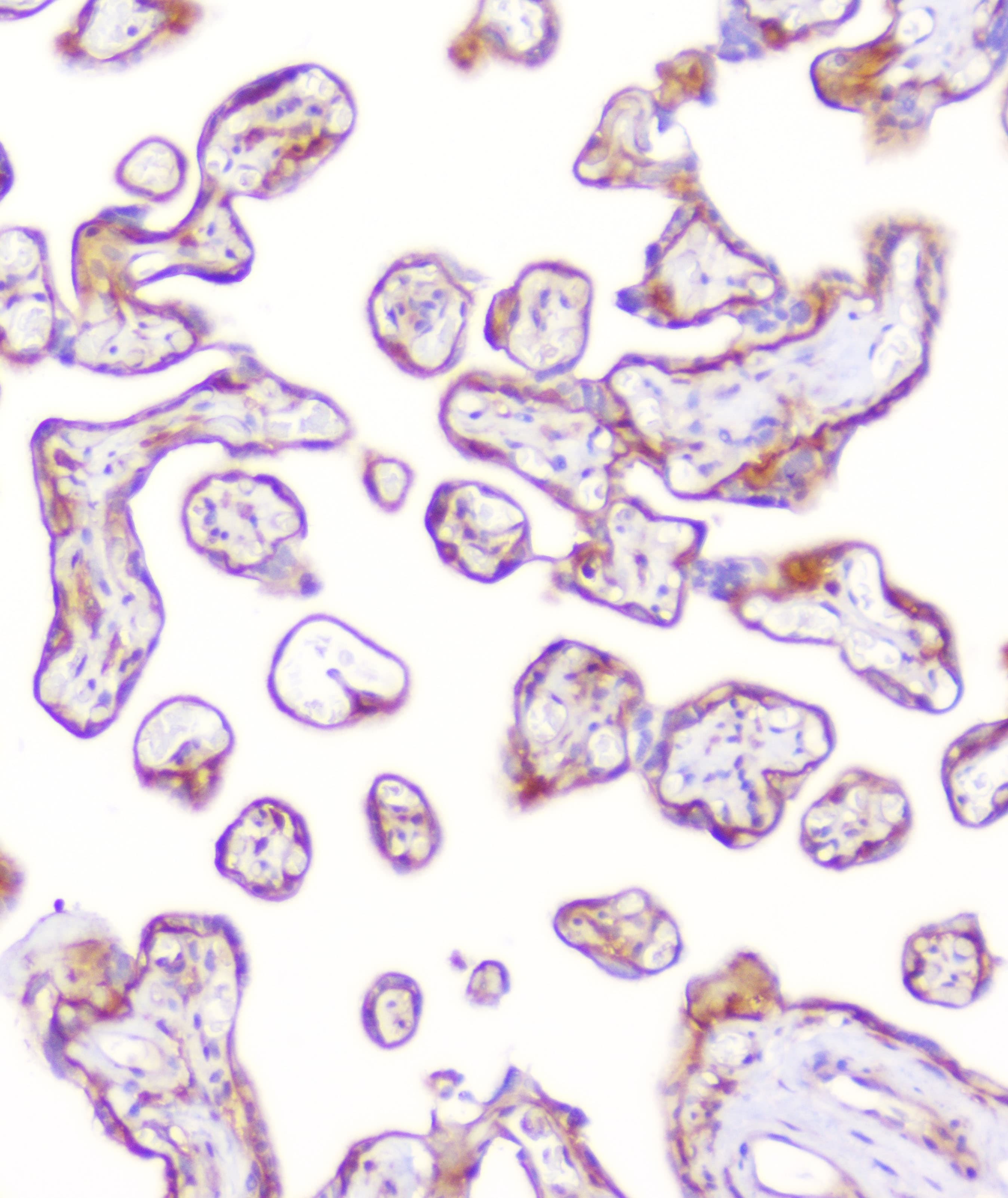Polyclonal Rabbit anti-Human RP2 Antibody (IHC, WB)