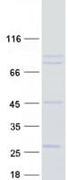 Human USP44 Protein (Recombinant Myc-DDK (Flag))