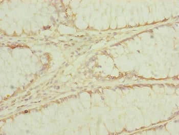 EF1G / EEF1G Antibody