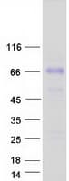 Human TCTN1 Protein (Recombinant Myc-DDK (Flag))