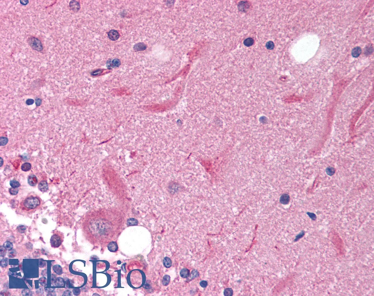 SOX11 Antibody (N-Terminus)