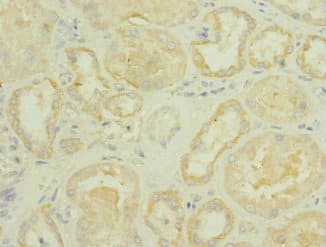 ROBO2 Antibody