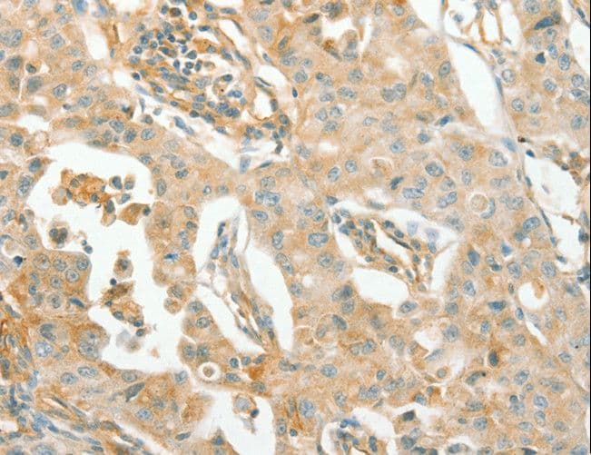 ACE / CD143 Antibody