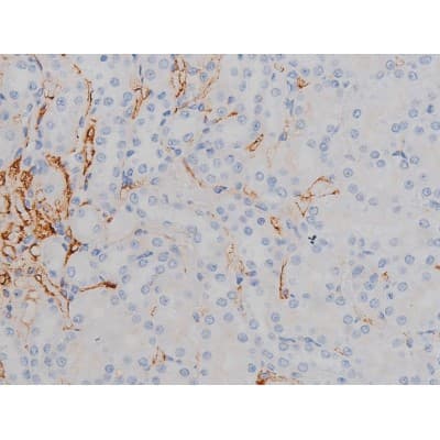 SNCA / Alpha-Synuclein Antibody (phospho-Ser129)