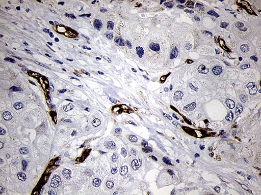FSCN1 / Fascin Antibody (clone OTI3D2)