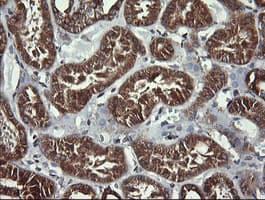 ACAA2 Antibody (clone OTI1D3)