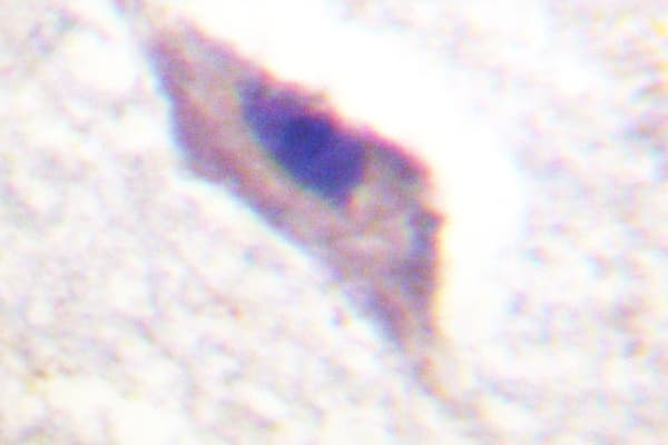 Polyclonal Rabbit anti-Human PRKD1 / PKC Mu Antibody (Arg201, IHC, IF, WB)