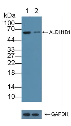 ALDH1B1 Antibody