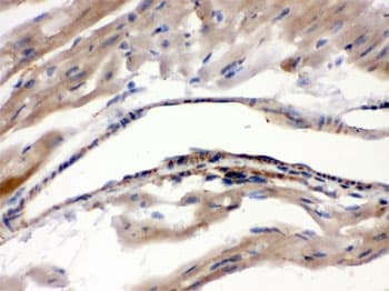 MAOA / Monoamine Oxidase Antibody