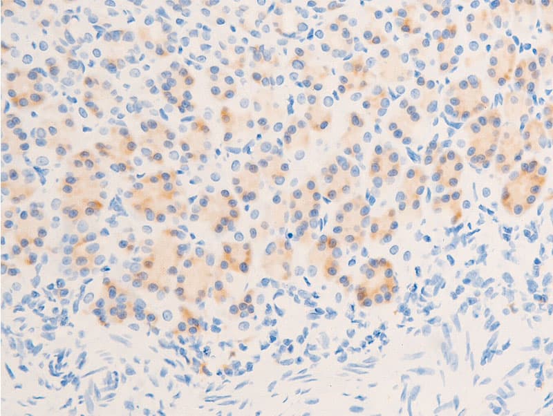 NR3C1/Glucocorticoid Receptor Antibody (phospho-Ser211)