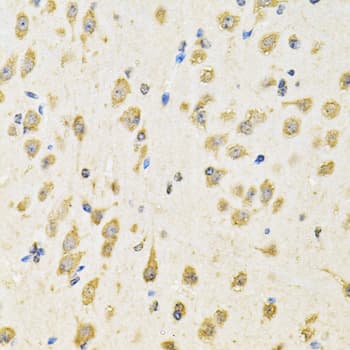 Polyclonal Rabbit anti-Human PTPRE / PTP Epsilon Antibody (IHC, WB)