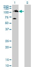 TYK2 Antibody (clone 6G12)
