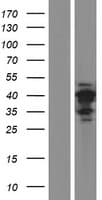 CT47A7 Protein (Over-Expression Lysate Myc-DDK (Flag))