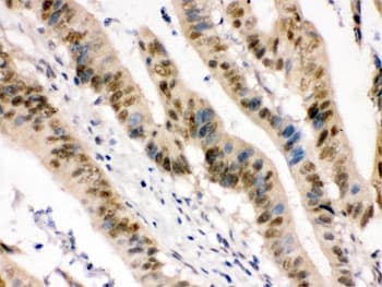 Polyclonal Rabbit anti-Human ZBTB7A / Pokemon Antibody (IHC, WB)