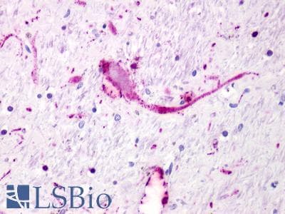 PathPlus™ GPR62 Antibody (Cytoplasmic Domain)