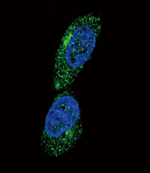 IHC-plus™ MICA Antibody (aa68-97)