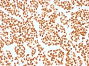 FOXA1 Antibody (clone FOXA1/1515)