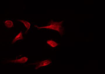 Polyclonal Rabbit anti-Human BCL2 / Bcl-2 Antibody (phospho-Ser87, IHC, IF, WB)