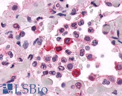 PathPlus™ ADGRE2 / EMR2 Antibody (N-Terminus)