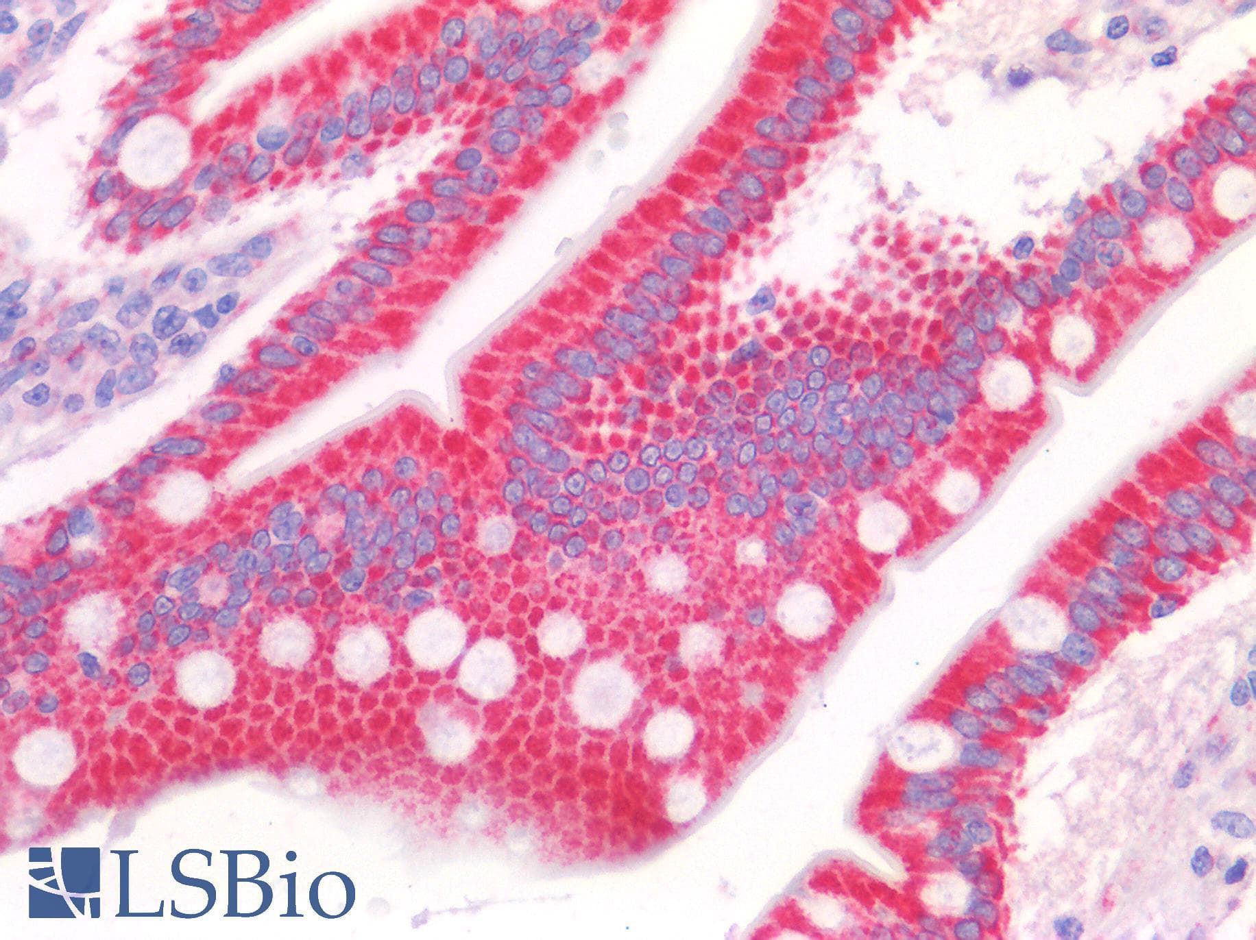 IHC-plus™ SYNJ2BP / OMP25 Antibody
