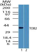 TOB2 Antibody (aa50-100)