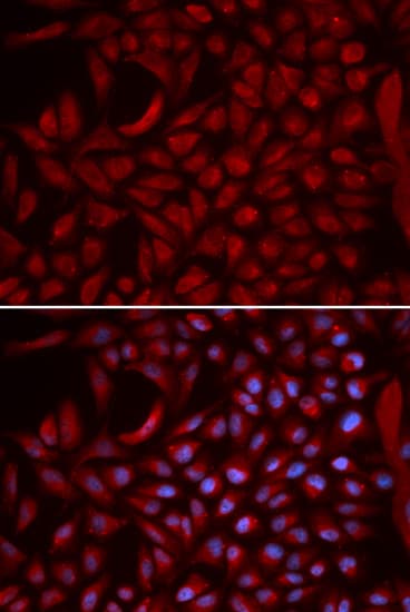 CUL5 / Cullin-5 Antibody