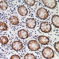 SMAD2 Antibody