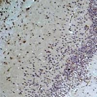 Polyclonal Rabbit anti-Human BEST1 / BEST / Bestrophin Antibody (IHC, WB)