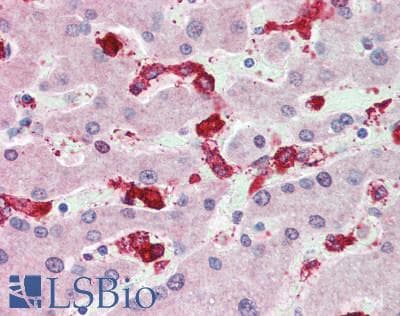 IHC-plus™ Polyclonal Rabbit anti-Human CYBA / p22phox Antibody (IHC, IF)