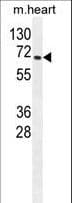 Monoclonal Mouse anti-Human RPS6KB2 / S6K2 Antibody (WB)