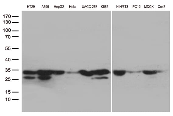 Monoclonal Mouse anti-Human SDHB Antibody (clone UMAB268, IHC, WB)