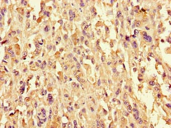Polyclonal Rabbit anti-Human CYSLTR1 / CYSLT1 Antibody