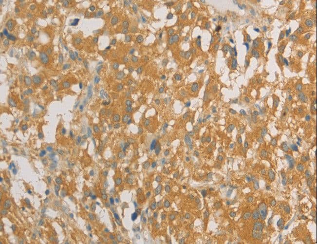 Polyclonal Rabbit anti-Human PRPSAP1 Antibody (IHC)