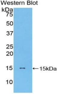 CCL2 / MCP1 Antibody (aa24-120)