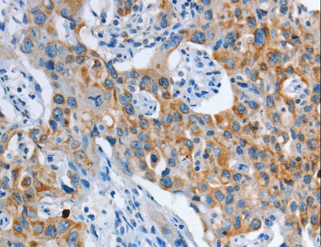 ASL / Argininosuccinate Lyase Antibody