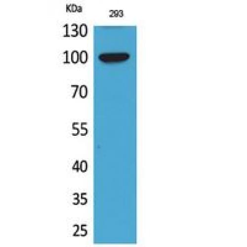 Polyclonal Rabbit anti-Human ENPP2 / Autotaxin Antibody (401-450 aa, Internal, WB)