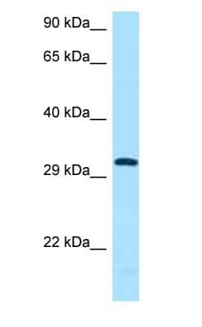CD84 / SLAMF5 Antibody (C-Terminus)