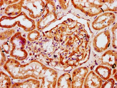 HOGA1 Antibody